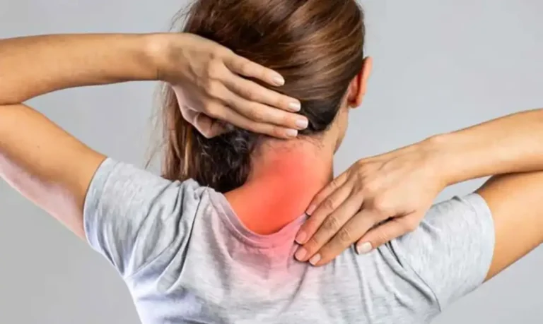 cervical algica