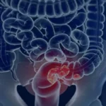 intestino