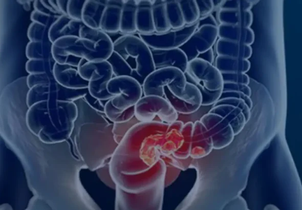 intestino