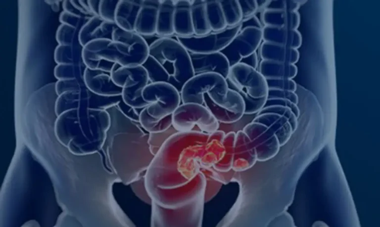 intestino